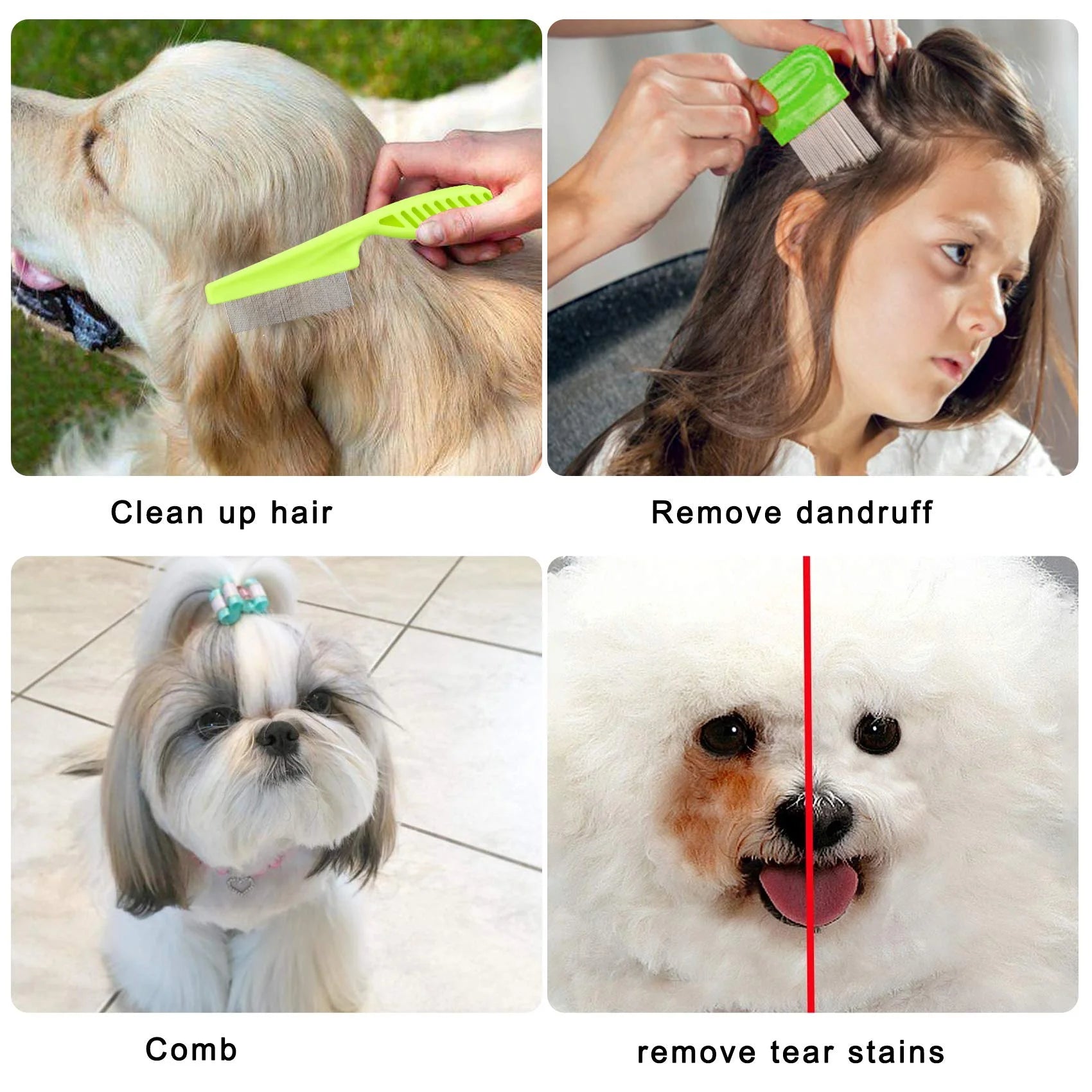 7 Pcs Pet Flea Lice Comb Dog Grooming Comb Stainless Steel Tick Combs Lice Remover Brush for Dog Cat